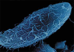 Think of all the <u>animals</u>, including <u>us</u>, on Earth... how ________ it is we all evolved from single-celled organisms.